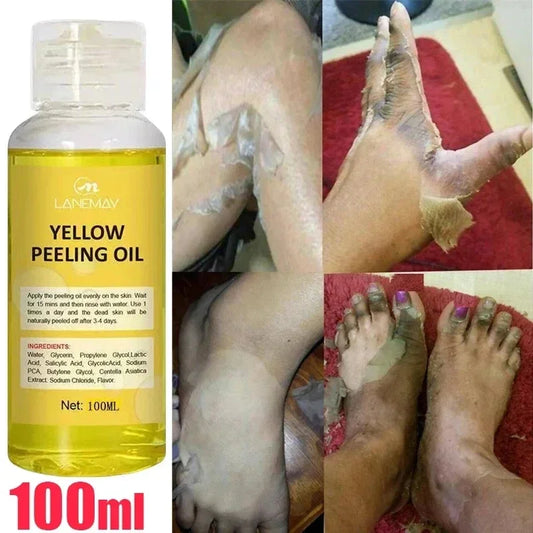 Yellow Peeling Oil 100% Organic Bleaching Dark Skin