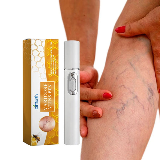 Lampshade therapy for varicose veins